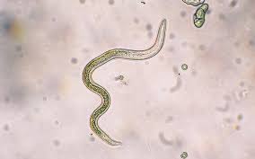Worms & Parasites